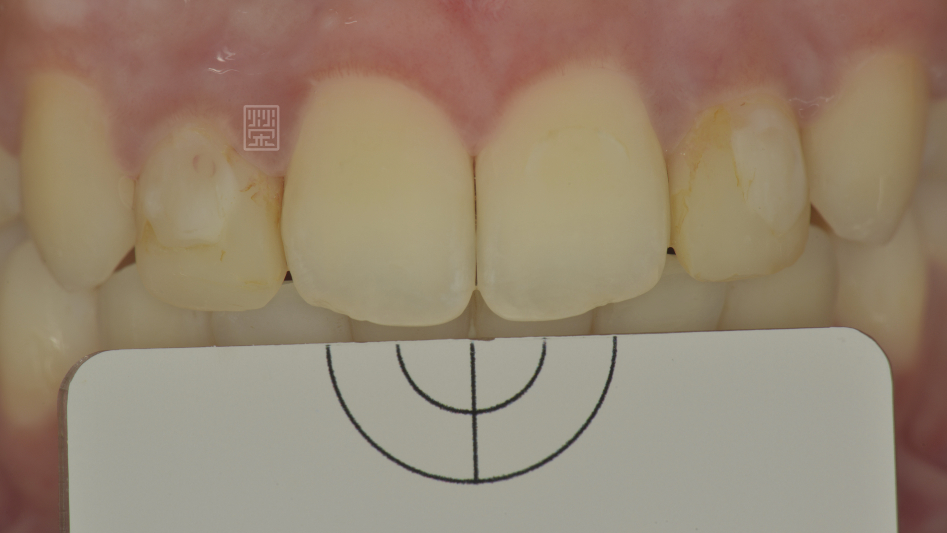 用偏光片協助顏色分析