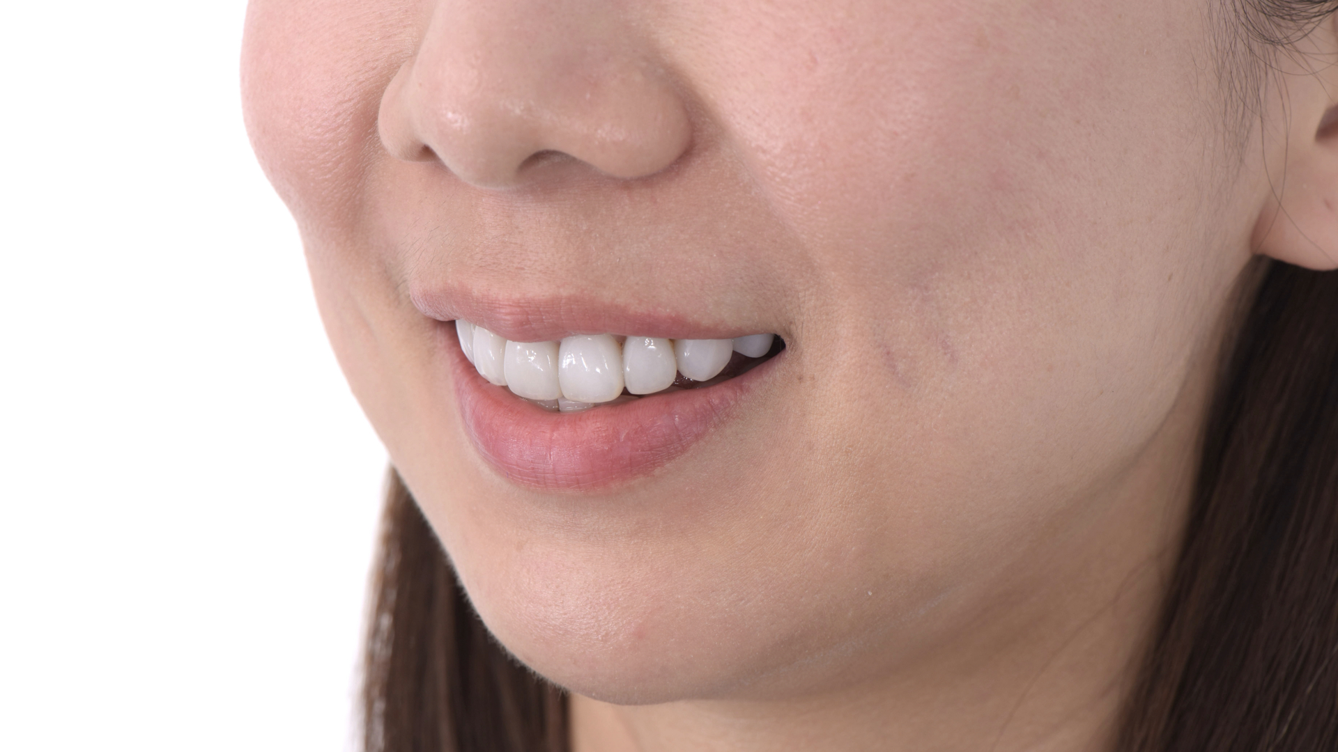 貼片與笑容的搭配