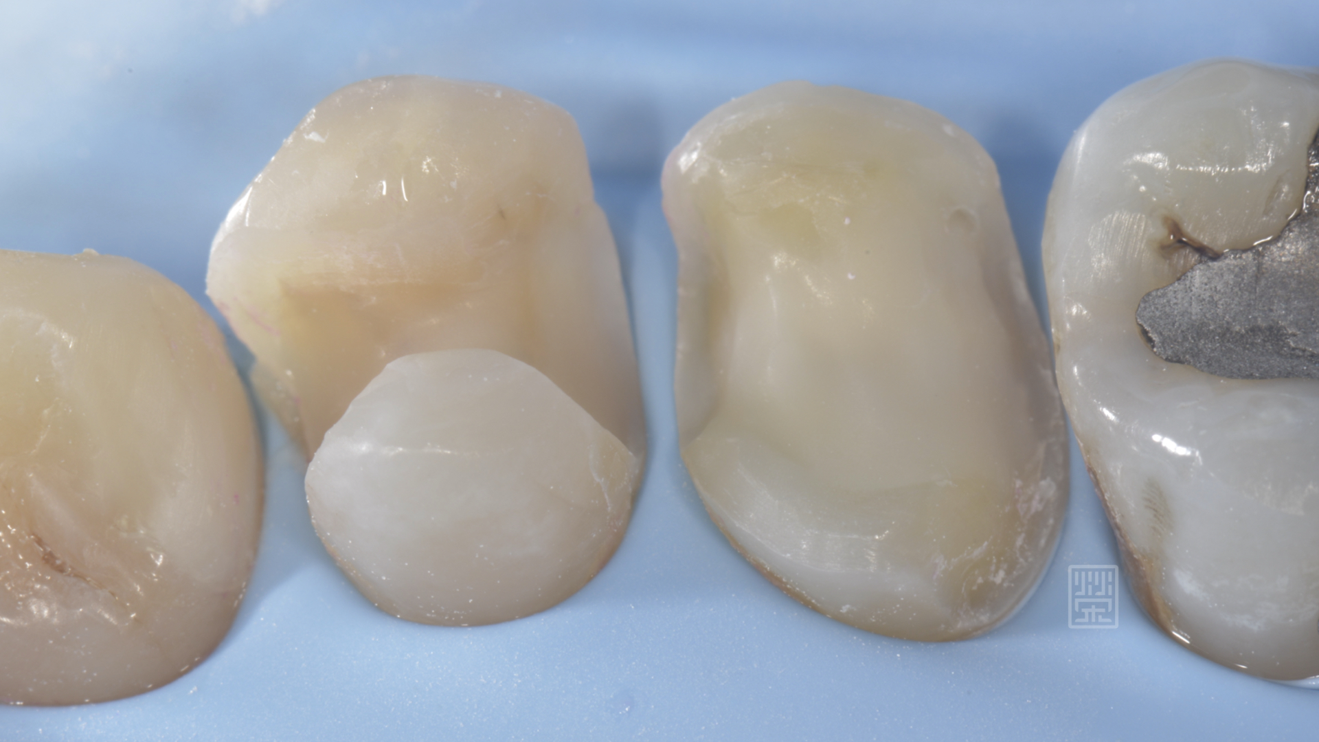 對於牙齒脆弱的部分，做包覆性保護牙齒