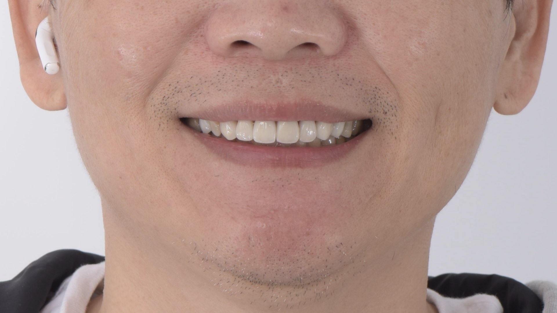 開心的笑~~
