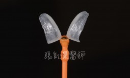 牙縫漏財---超薄貼片修復