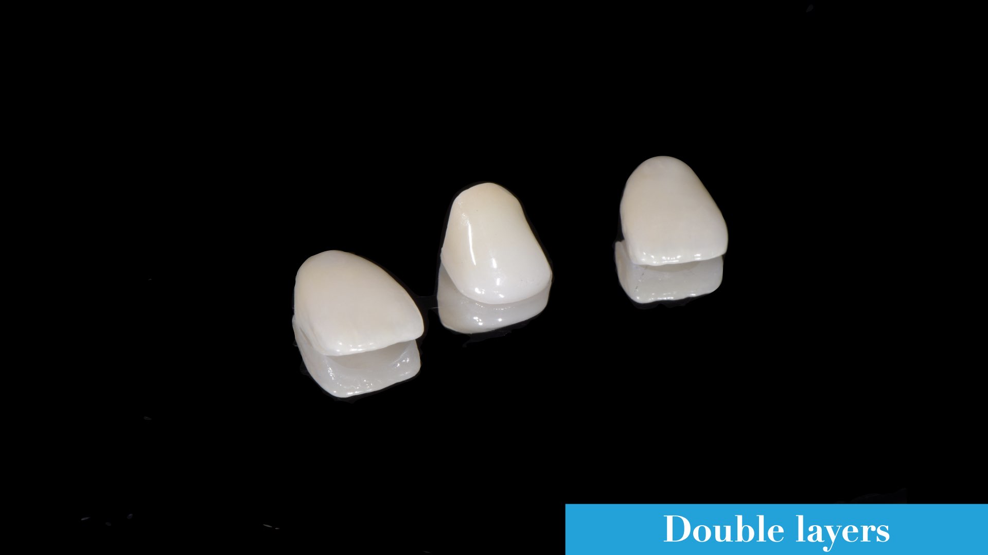 雙層全瓷冠與貼片