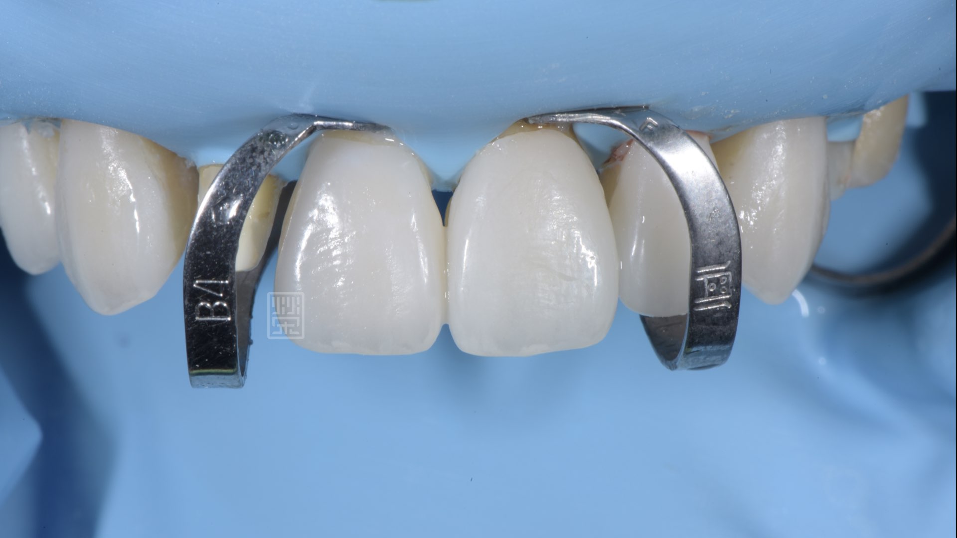 橡膠皮帳隔濕促進貼片黏著穩定