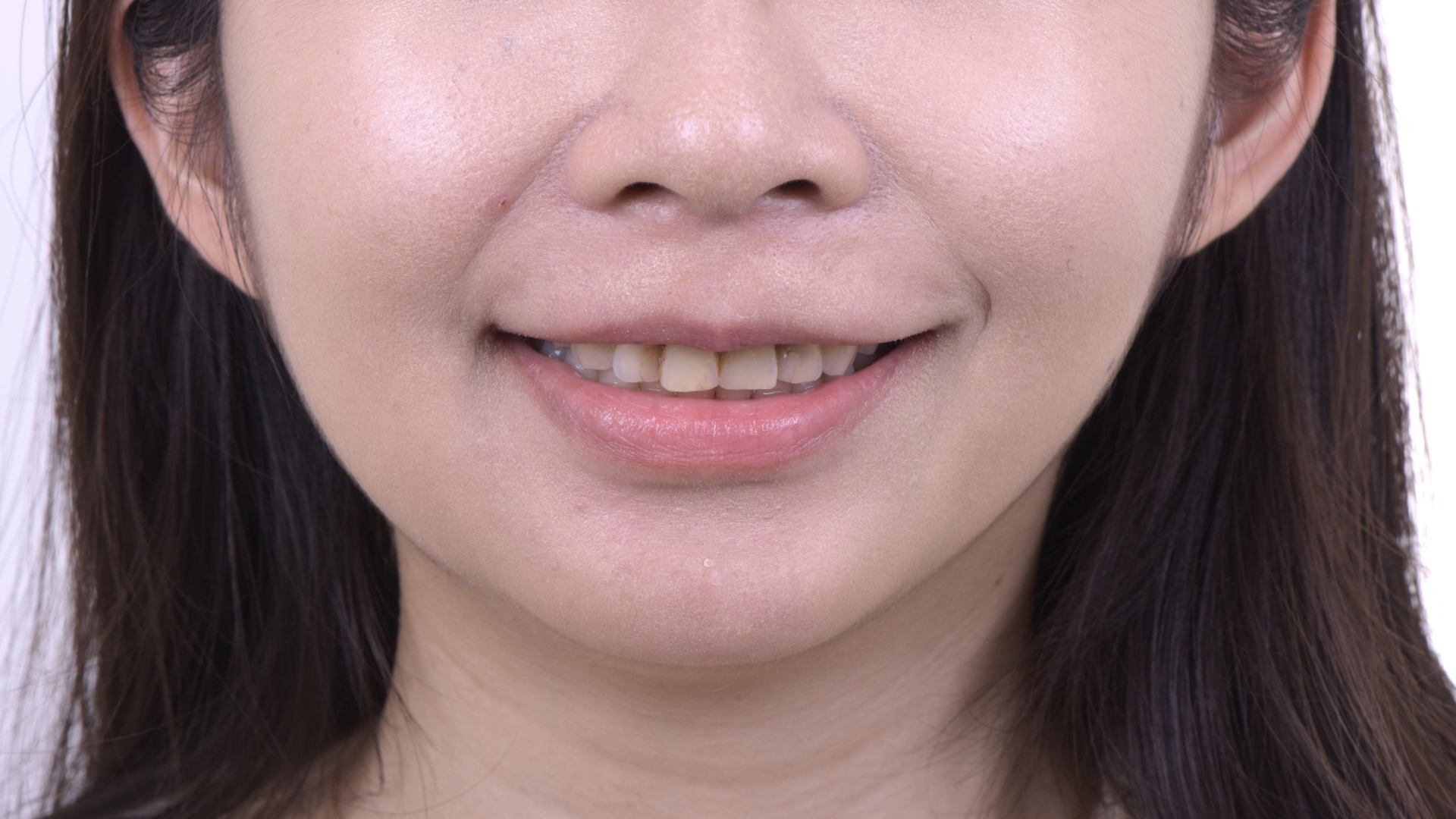 門齒長度偏短，曲線較平